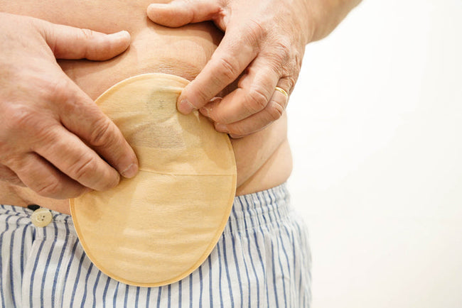 Ostomy Ramp Ostomy Output: What It Means & How to Change It – Ostomy Care Supply